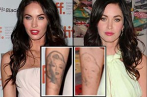 Megan Fox Tattoo Removal